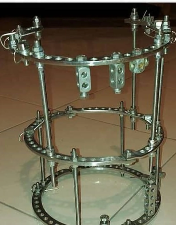 جهاز اليزاروف مثبت خارجي للساق استعمال 4 شهور فقط وسعر للحالات الطارئه